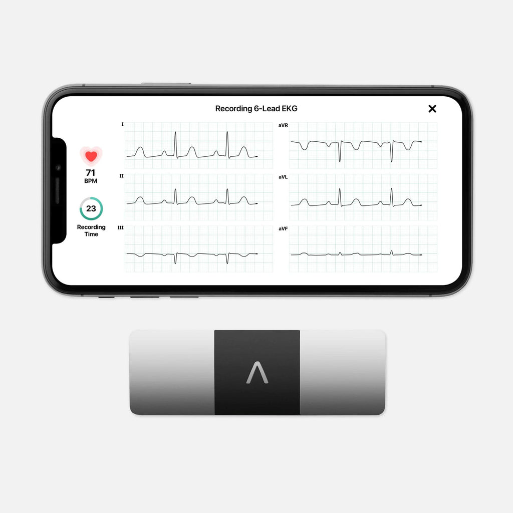 AliveCor KardiaMobile Personal EKG 6L