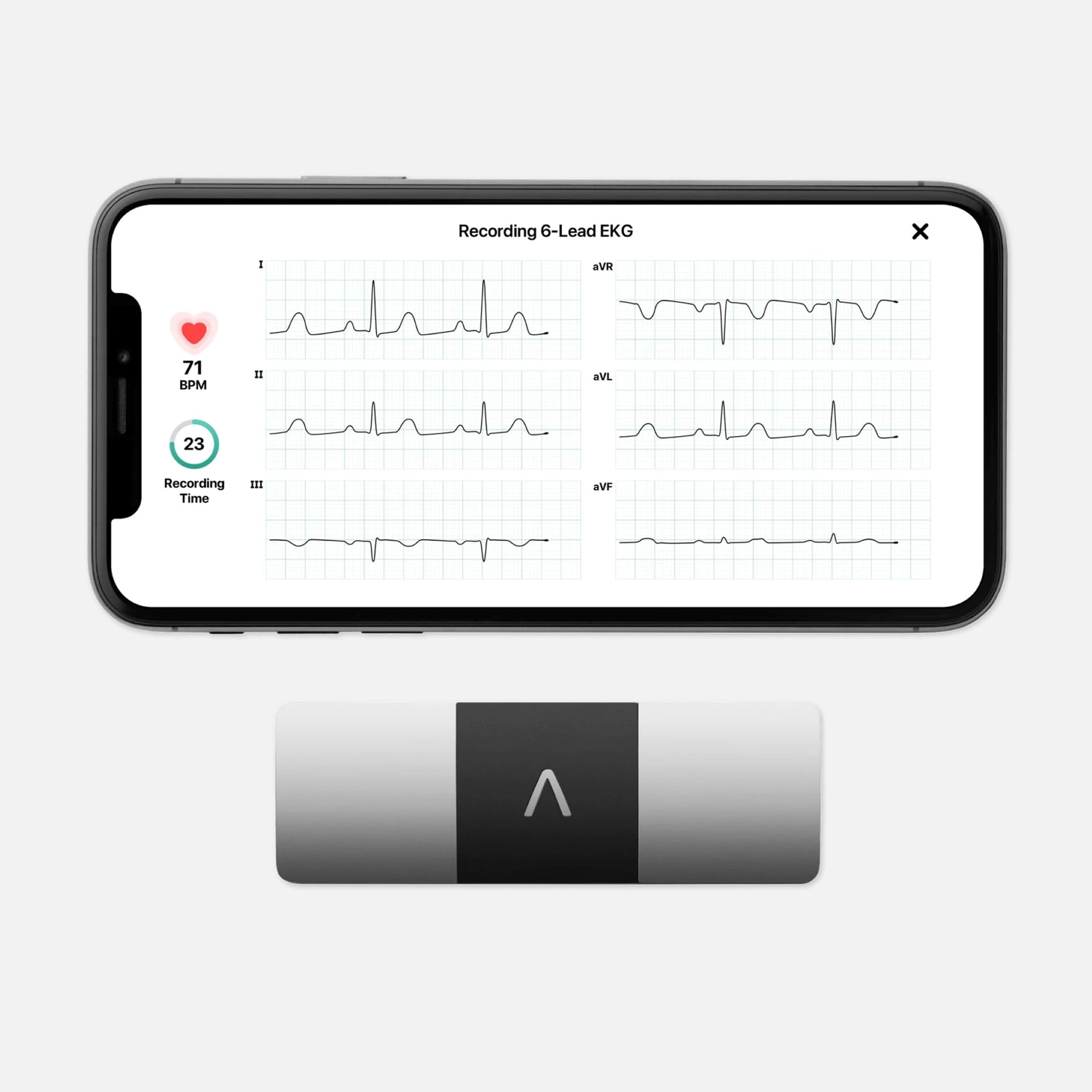 AliveCor KardiaMobile Personal EKG 6L
